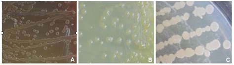 Isolation, identification and characterization of novel Bacillus subtilis.